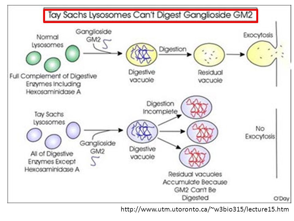 Hexa And Tay Sachs Disease Ppt Download