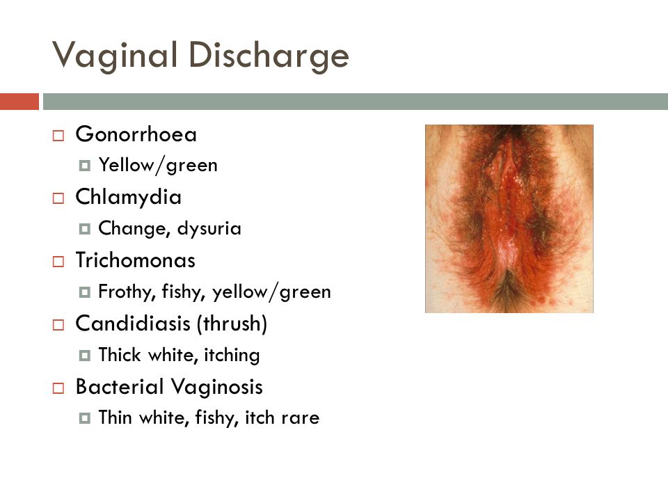 Glob of discharge early pregnancy