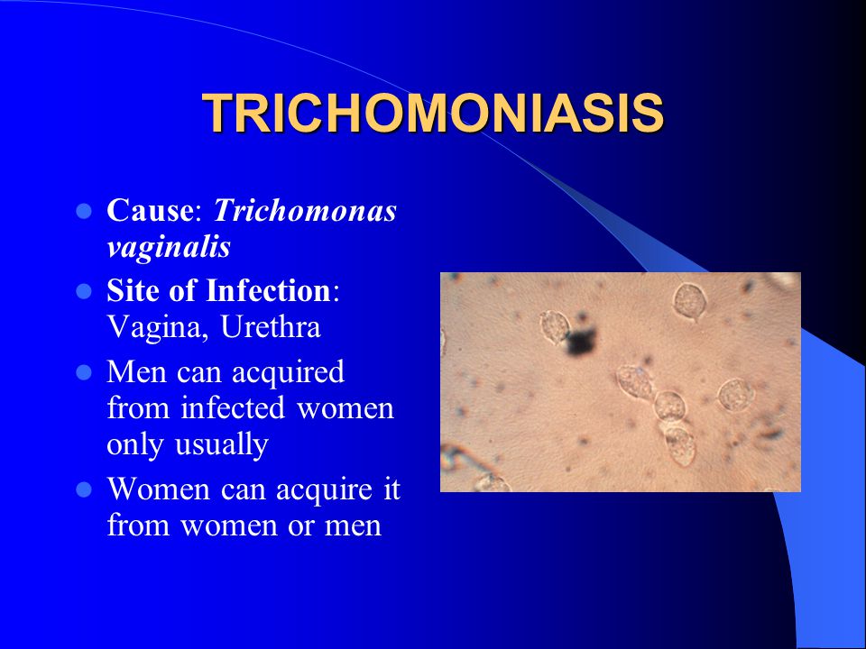 A prostatitis miatt Trichomoniasis megjelenhet