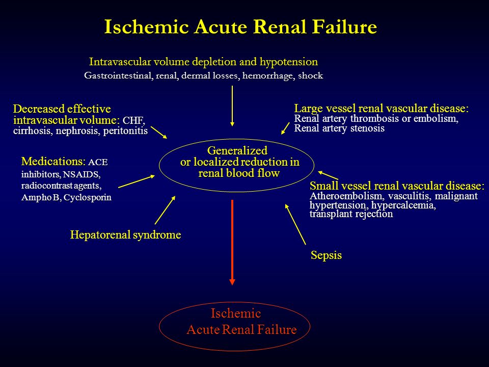 Acute перевод. Renal failure. Acute renal failure. Acute renal failure причины.
