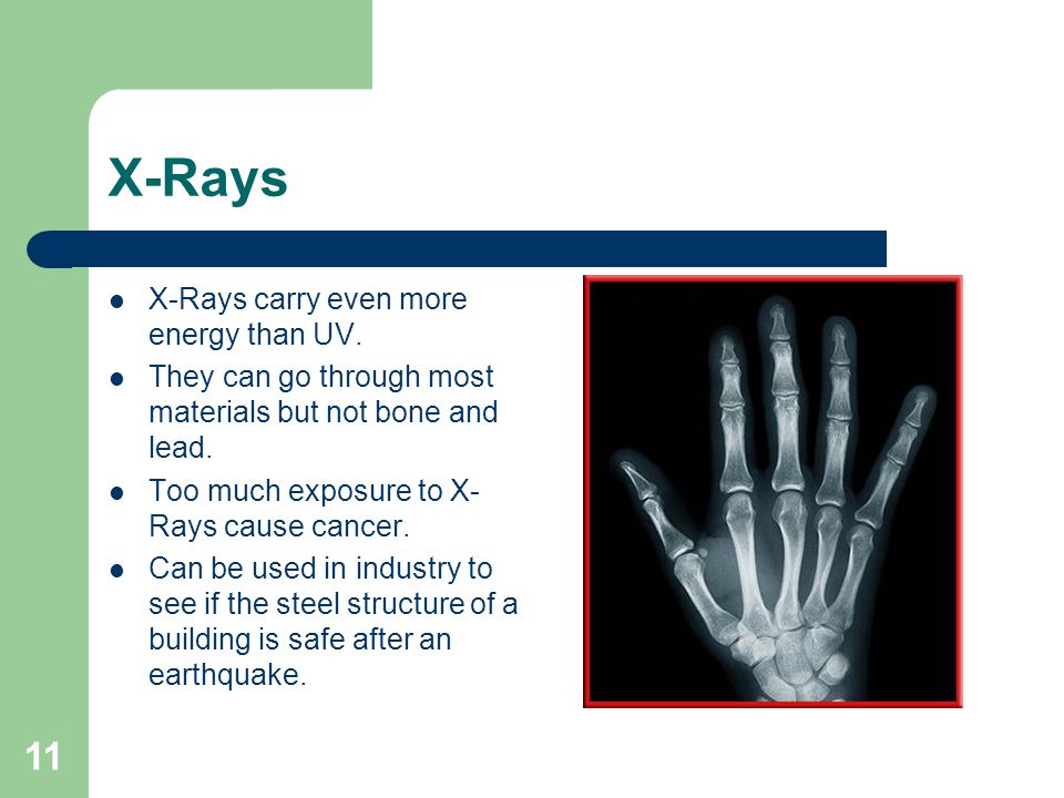 X-Rays X-Rays carry even more energy than UV.