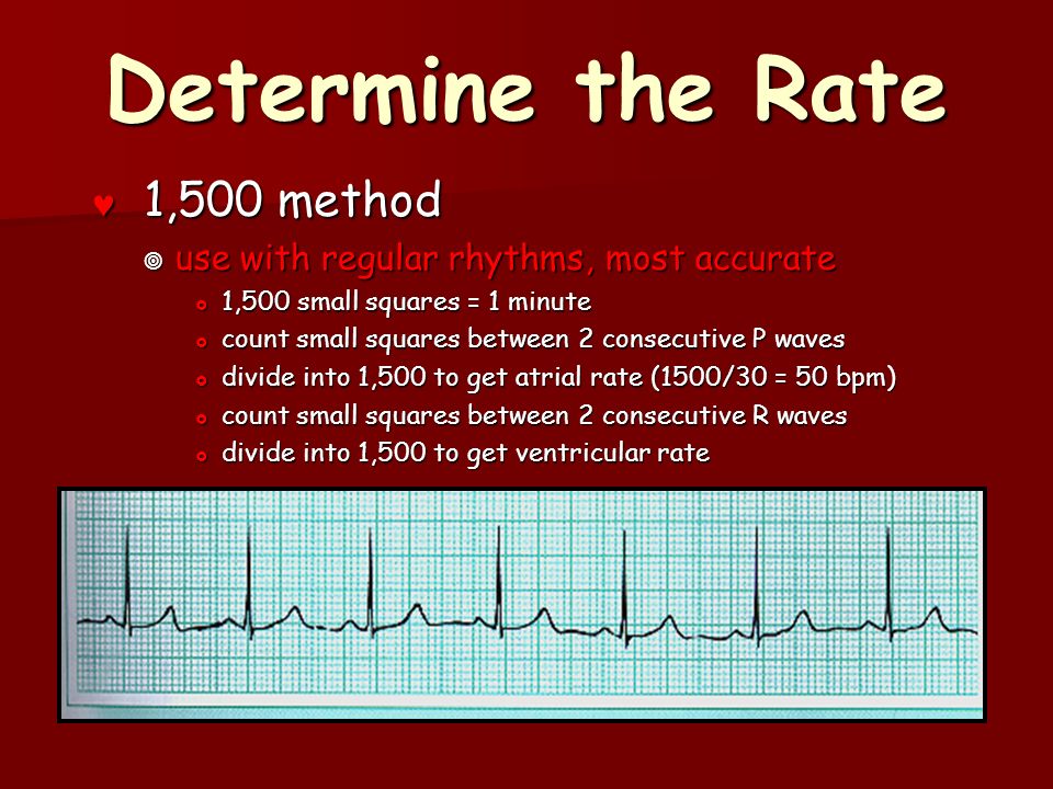 Basic Ecg Ppt Video Online Download