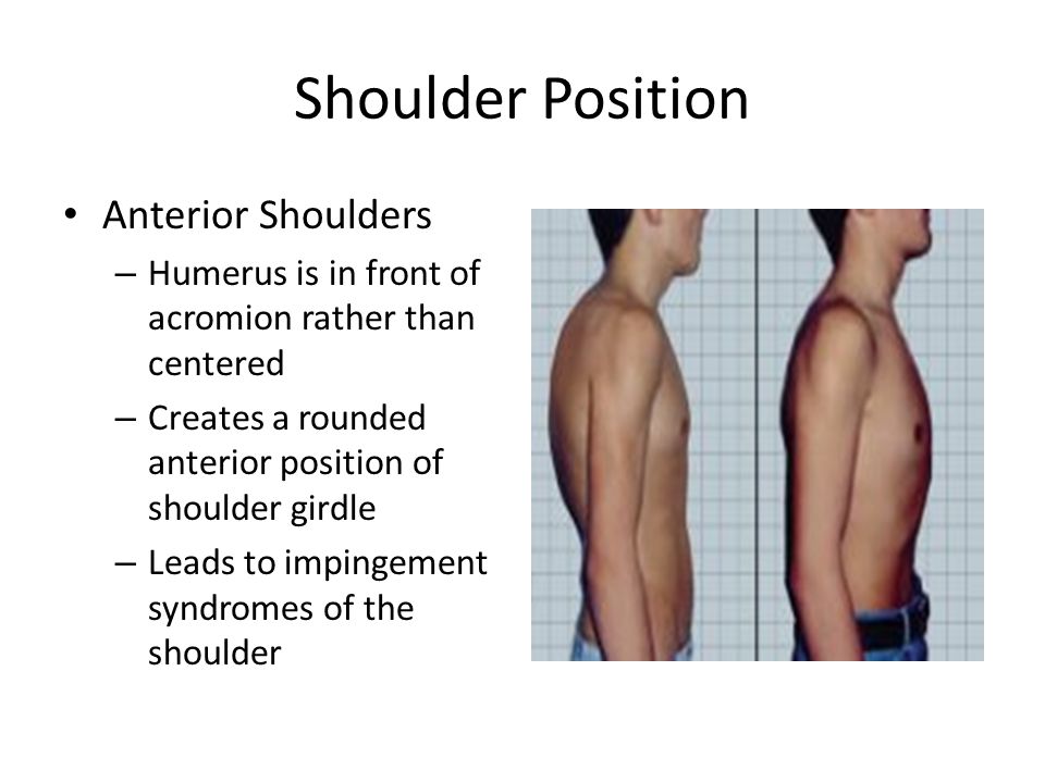 Rounded Shoulders, Forward Head, And Kyphosis, Oh My! - How To Fix