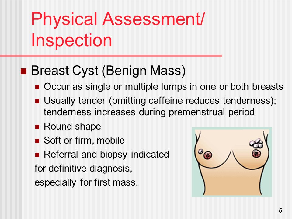 What causes tender heavy breasts
