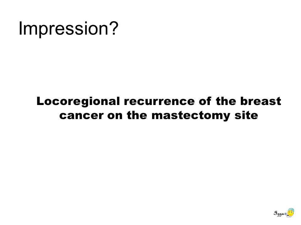 Locoregional recurrence of the breast cancer on the mastectomy site