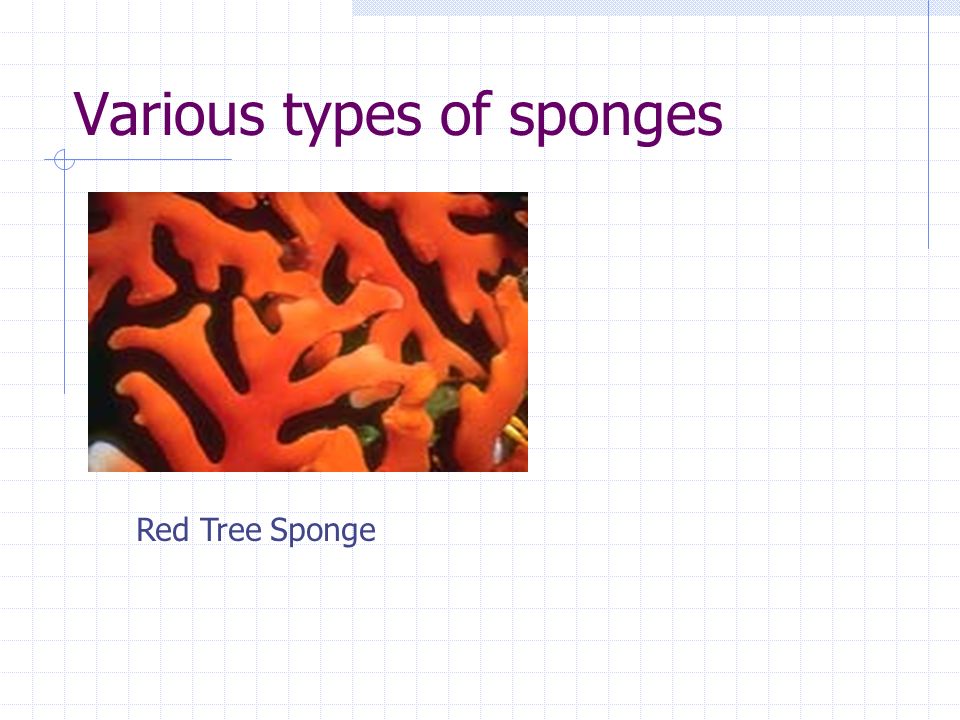 Various types of sponges