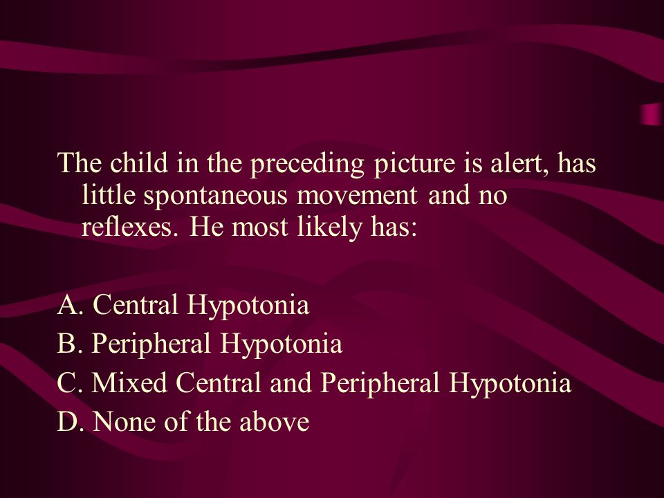The child in the preceding picture is alert, has little spontaneous movement and no reflexes. He most likely has: