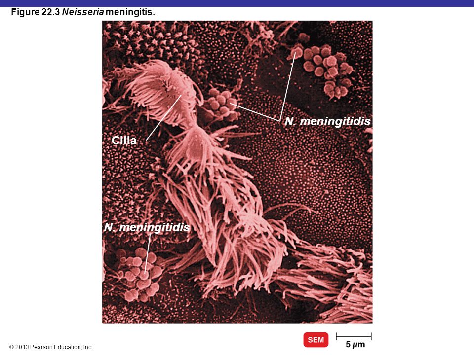 N. meningitidis Cilia N. meningitidis