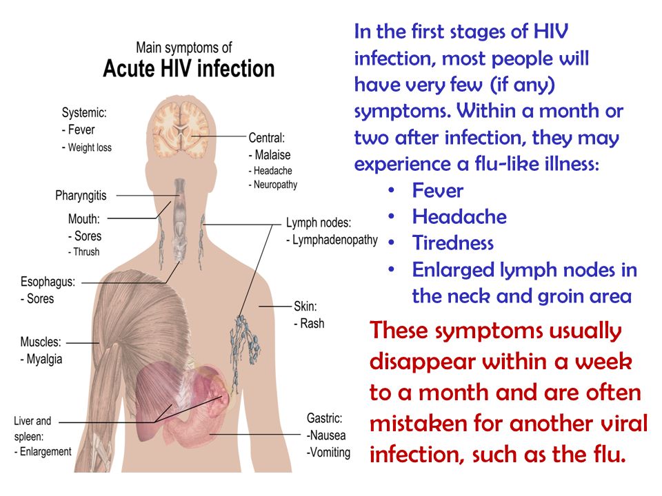 In the first stages of HIV infection, most people will have very few (if any) symptoms. Within a month or two after infection, they may experience a flu-like illness: