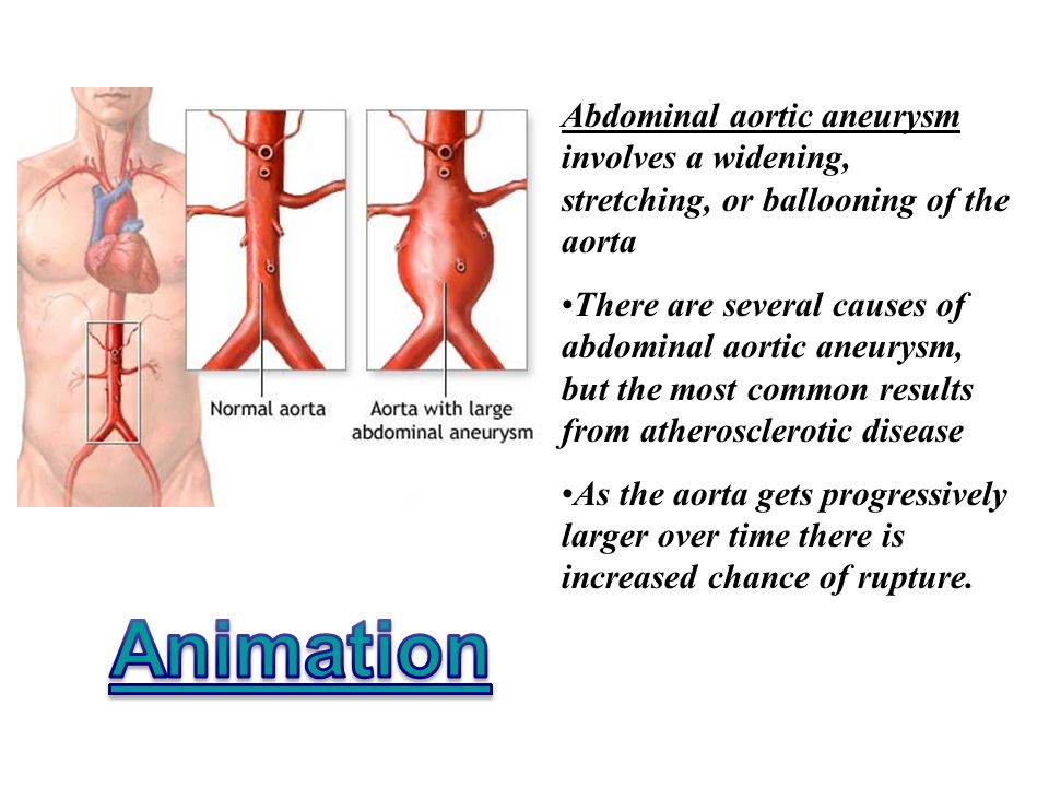Aorta Oh Сливы