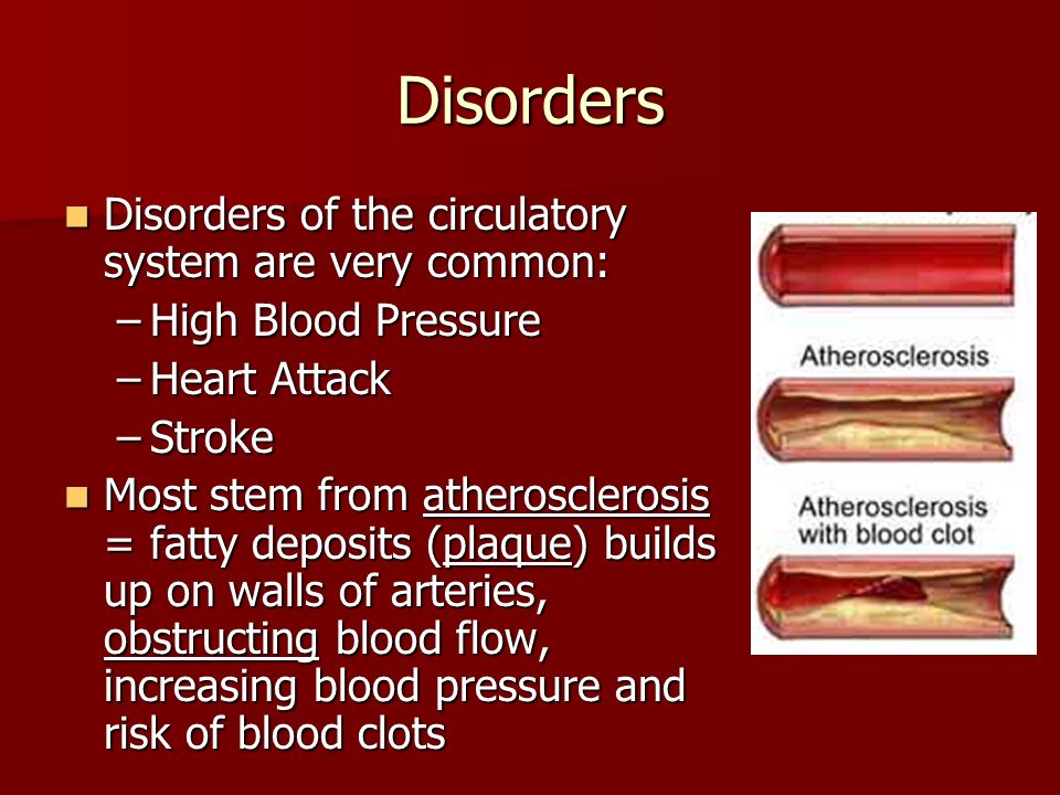 Disorders Disorders of the circulatory system are very common: