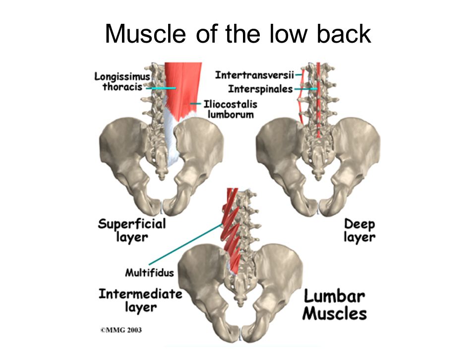 Multifidus muscle анатомия