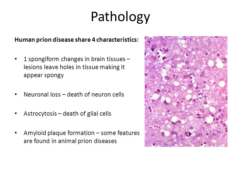 Pathology Human prion disease share 4 characteristics.
