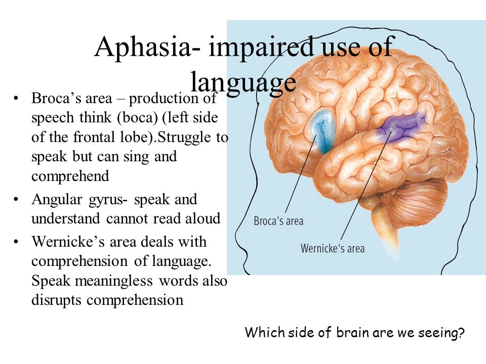 Aphasia- impaired use of language