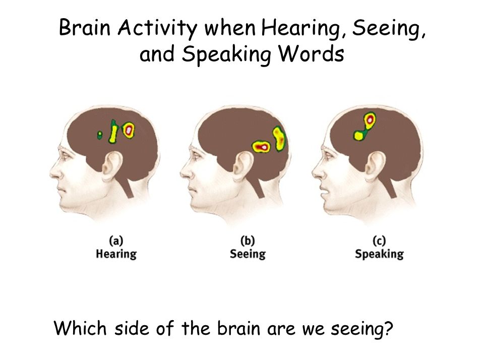 Brain Activity when Hearing, Seeing, and Speaking Words
