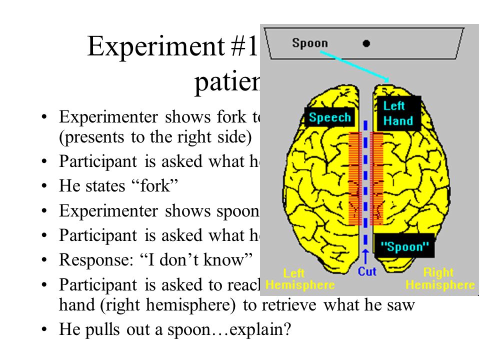 Experiment #1 Split-brain patients