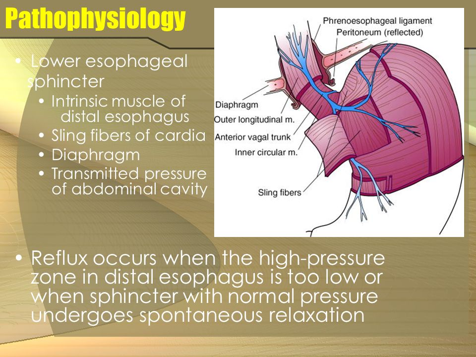 Pathophysiology Lower esophageal. sphincter. Intrinsic muscle of distal esophagus.