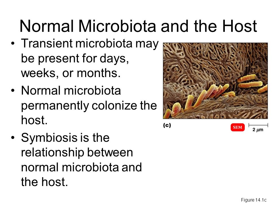transient microbiota differ from normal microbiota