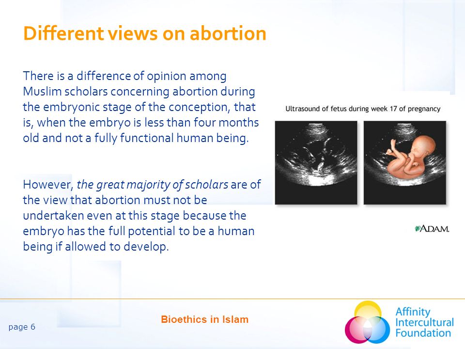 Different views on abortion