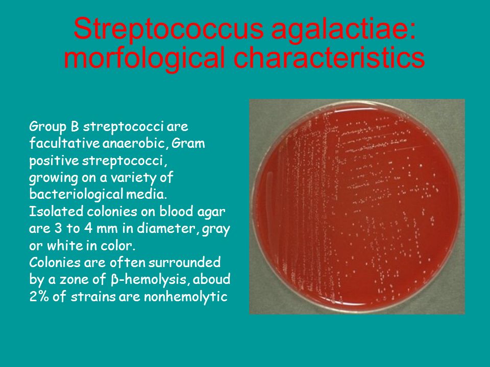 Стрептококки у женщин лечение. Стрептококк пентогенус Streptococcus pyogenes. Streptococcus agalactiae микробиология. Бактерия Streptococcus agalactiae. Стрептококкус агаре стрептококк на кровяном.