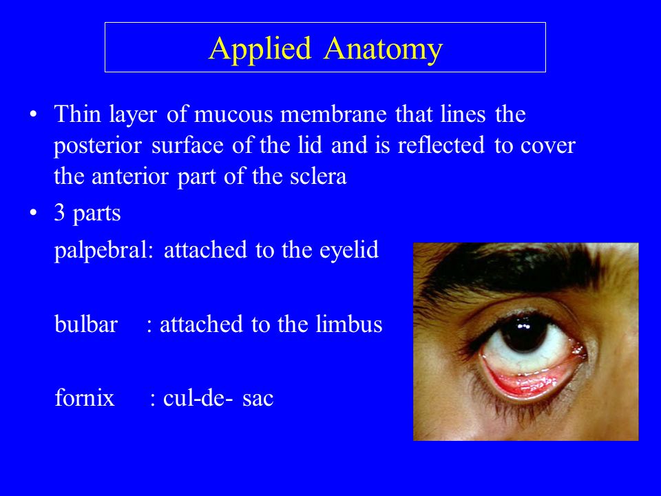 Conjunctiva Applied anatomy Evaluation of conjunctival inflammation - ppt  video online download