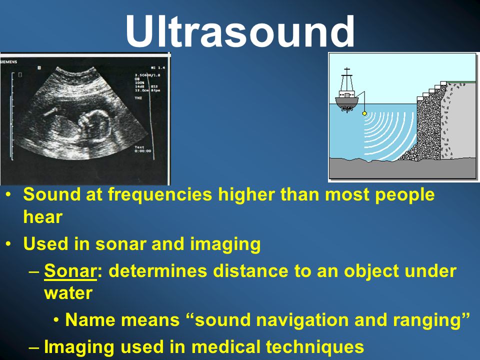 Ultrasound Sound at frequencies higher than most people hear