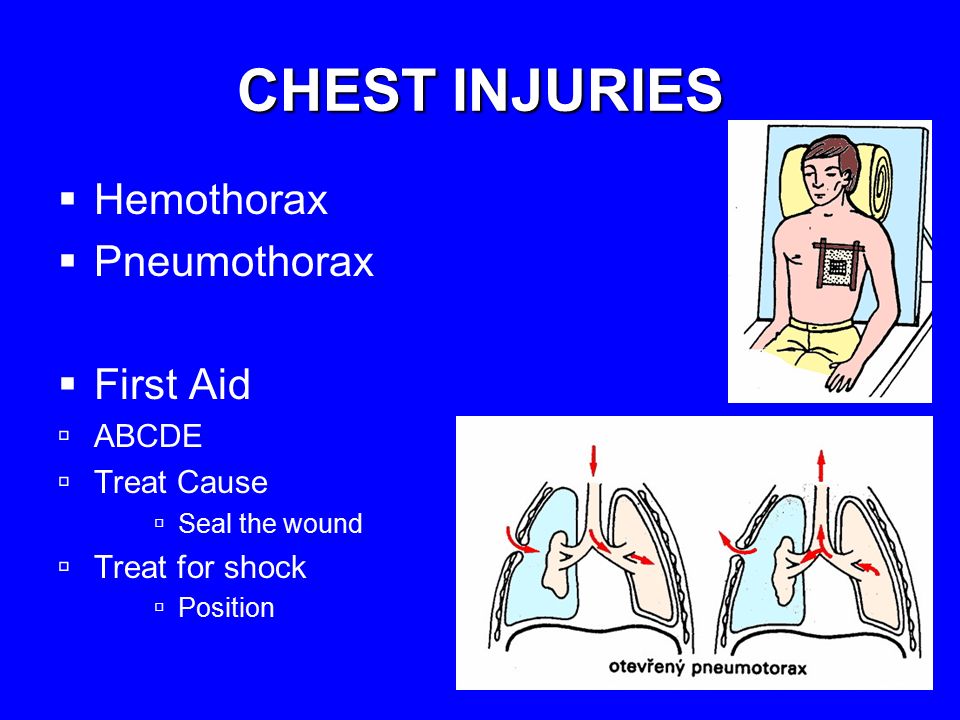 First Aid in Chest Injuries