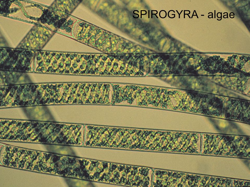 Разрежьте водоросли геншин. Спирогира в микроскопе. Спирогира клетки микроскоп. Конъюгация спирогиры микроскоп. Спирогира под микроскопом.
