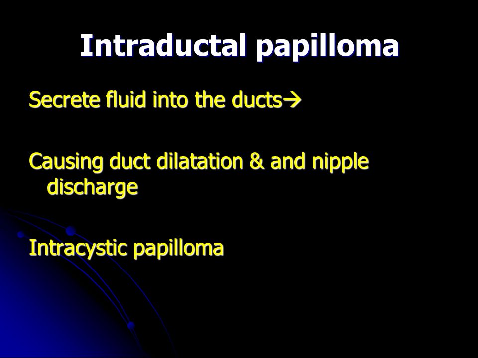 Que es ectasia ductal y papiloma intraductal. Ce se întâmplă dacă au existat scurgeri din sani?