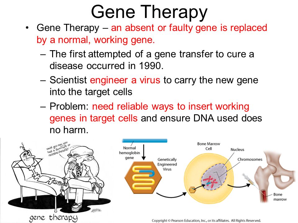 Gene Therapy Gene Therapy – an absent or faulty gene is replaced by a normal, working gene.