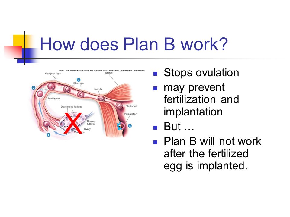 Plan B After Ovulation Does Work