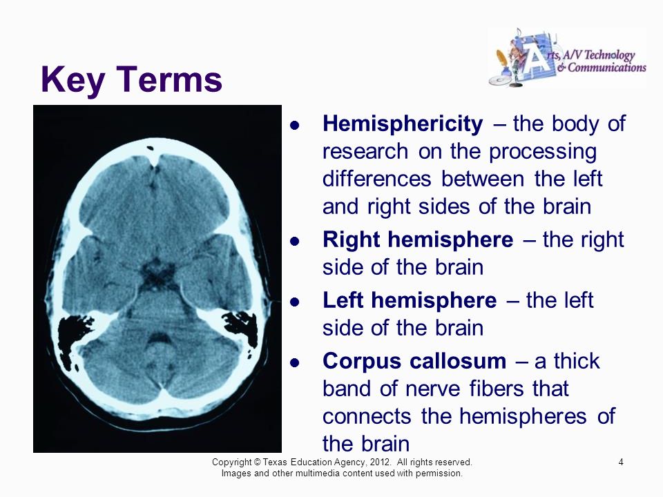 Key Terms Hemisphericity – the body of research on the processing differences between the left and right sides of the brain.