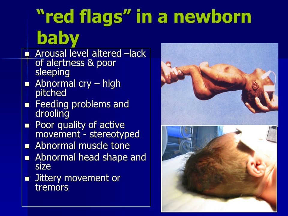 Newborn Baby Tremors Newborn Baby