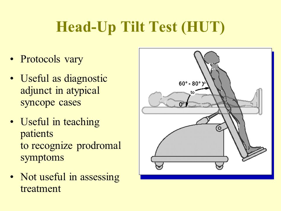 Study protocol for head-up tilt test (HUT).