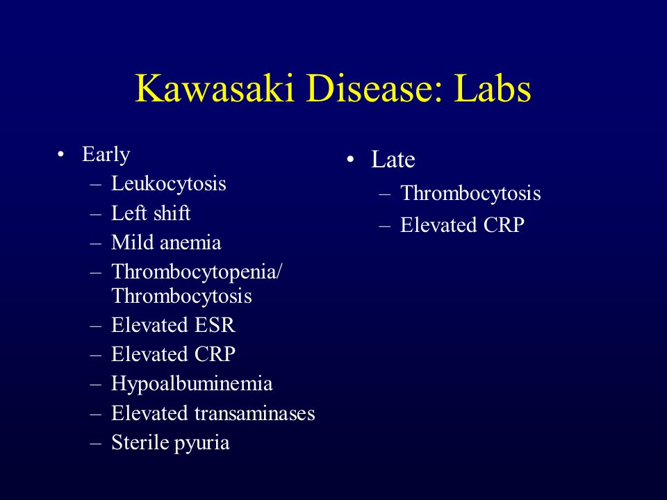 Kawasaki Disease: An Update - ppt download