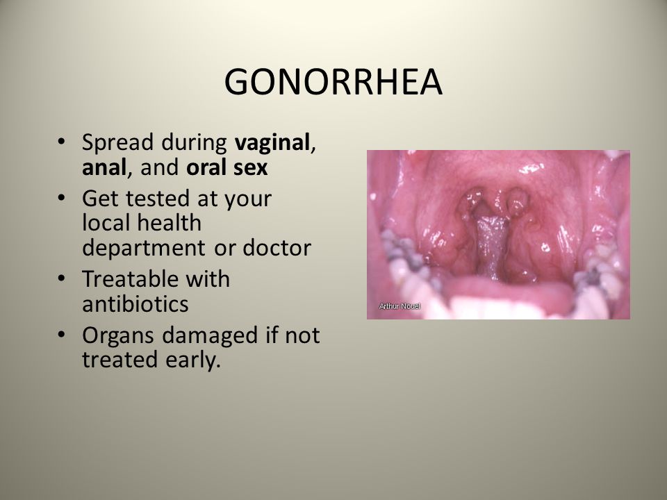 Diseases Passed By Oral Sex