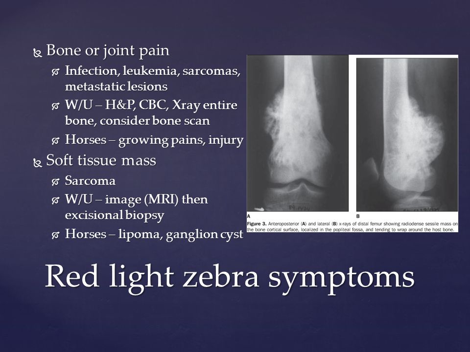 Red light zebra symptoms