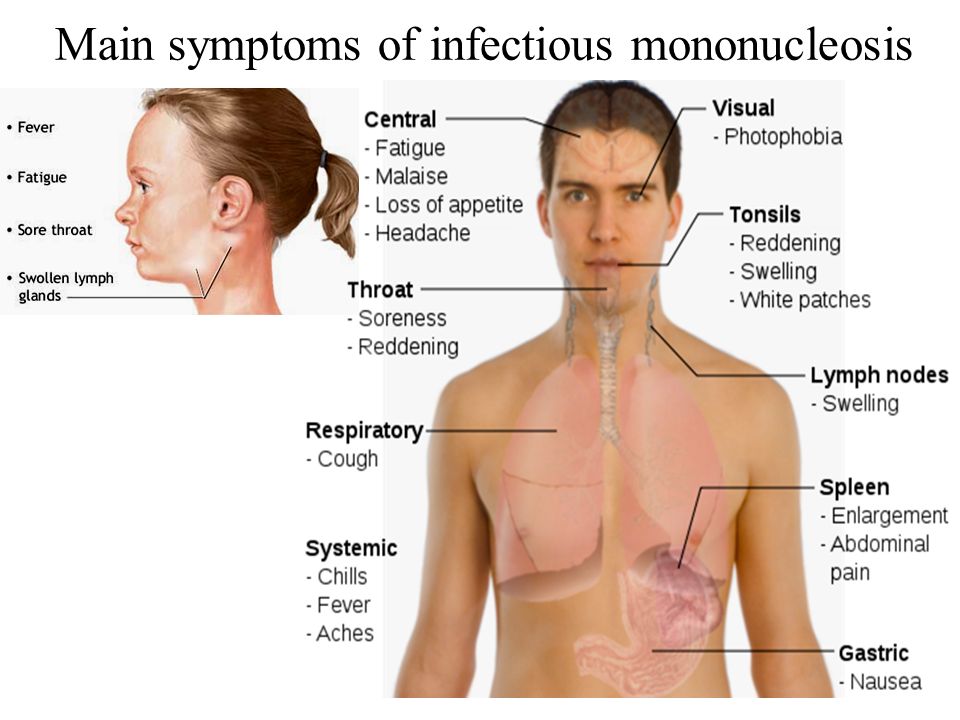 Main symptoms of infectious mononucleosis.