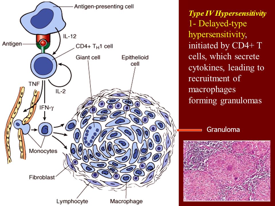 Макрофаги 1 3. Сенсорные клетки. Макрофаги это клетки. Тучные клетки это макрофаги. Макрофак и тучгные коеикпиэ.