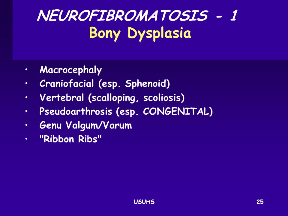 NEUROFIBROMATOSIS ‑ 1 Bony Dysplasia