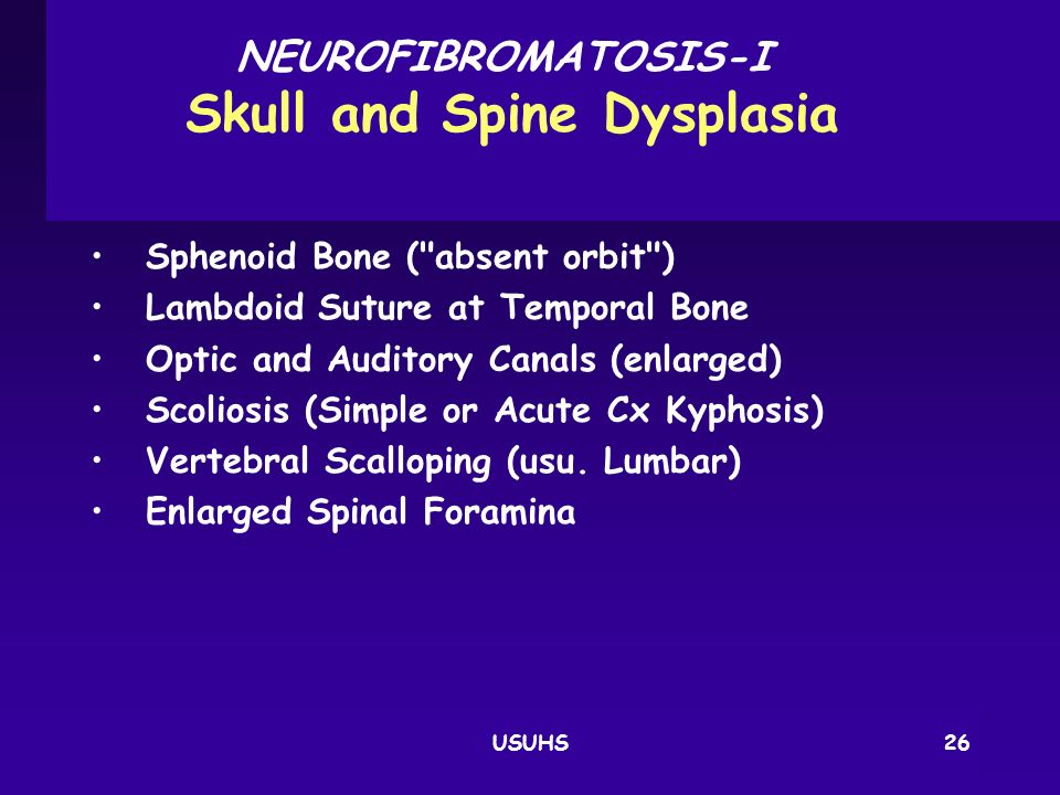 NEUROFIBROMATOSIS‑I Skull and Spine Dysplasia