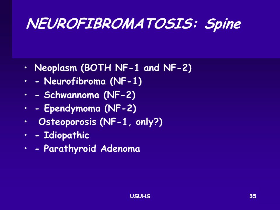 NEUROFIBROMATOSIS: Spine