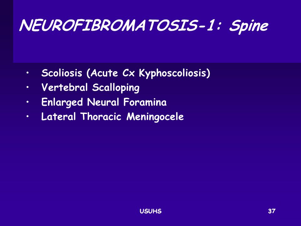 NEUROFIBROMATOSIS‑1: Spine