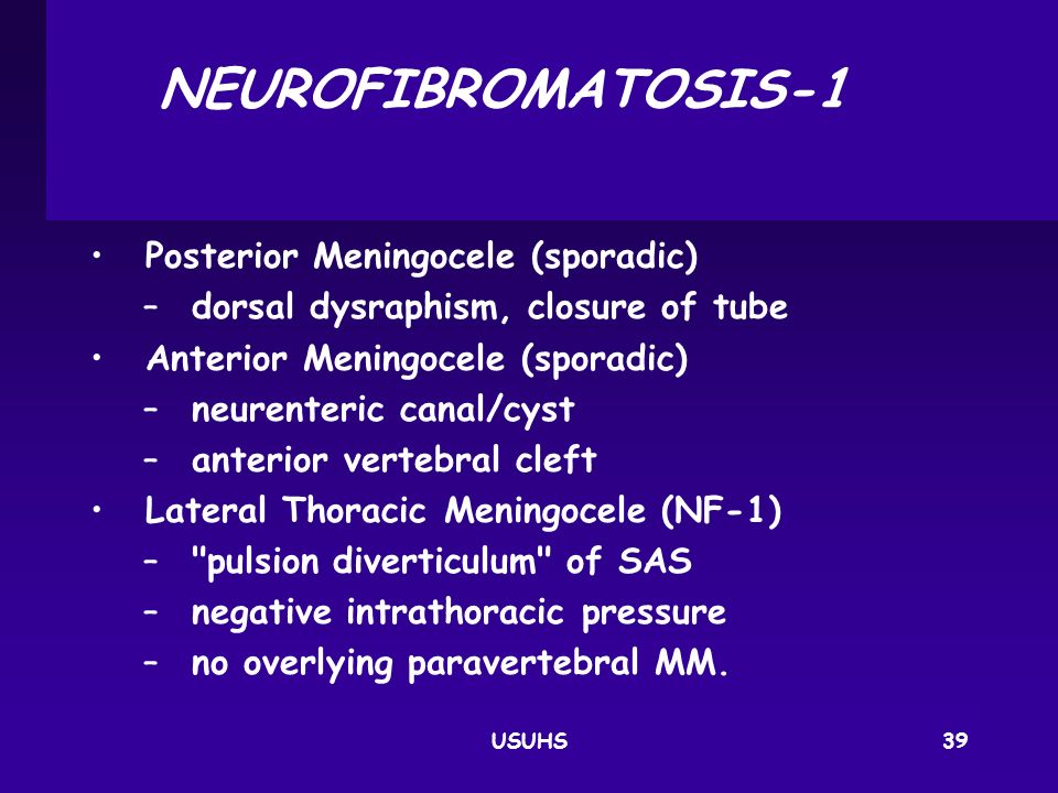 NEUROFIBROMATOSIS‑1 Posterior Meningocele (sporadic)