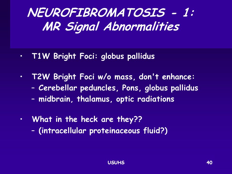 NEUROFIBROMATOSIS ‑ 1: MR Signal Abnormalities