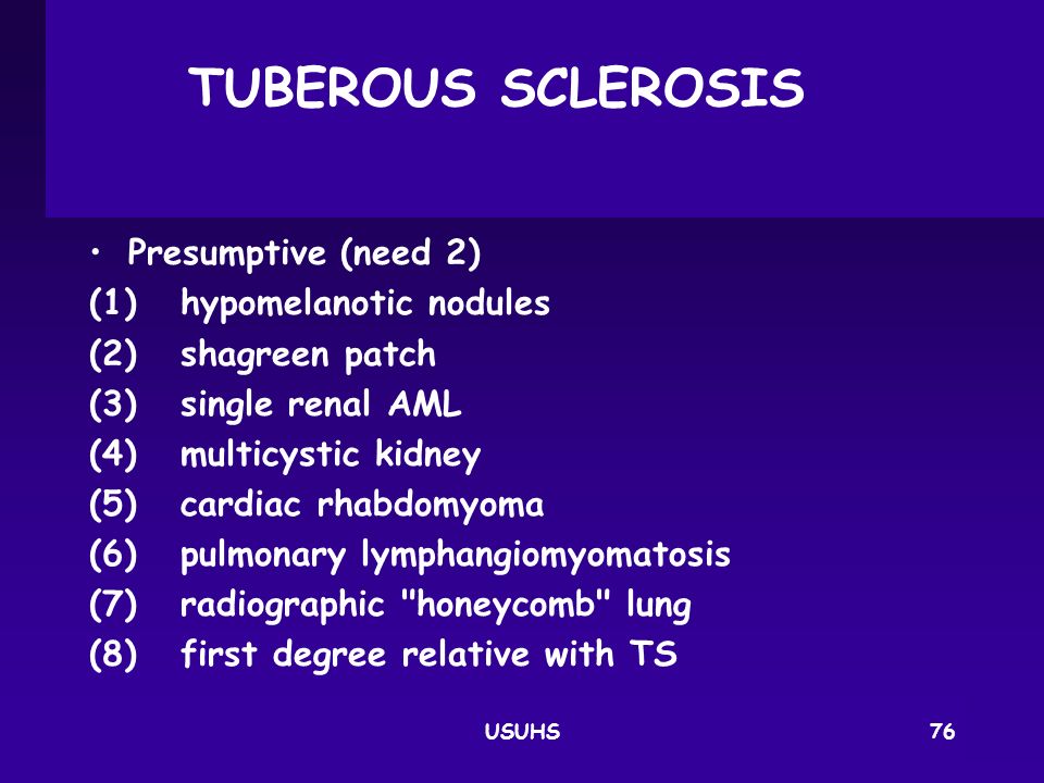 TUBEROUS SCLEROSIS Presumptive (need 2) (1) hypomelanotic nodules