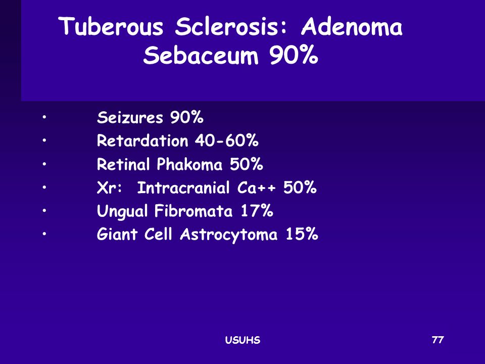 Tuberous Sclerosis: Adenoma Sebaceum 90%