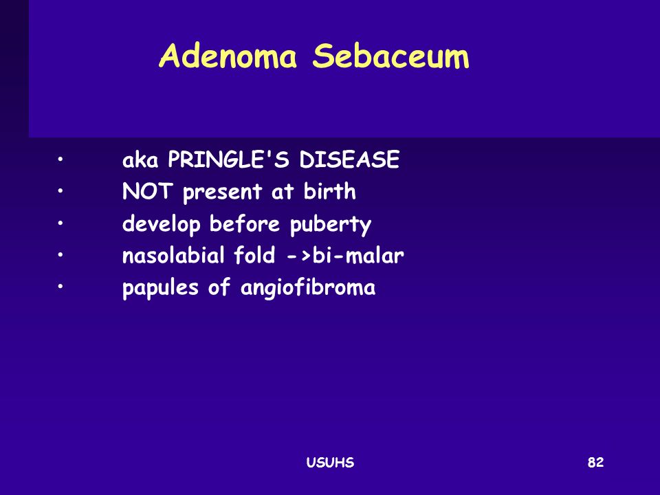 Adenoma Sebaceum aka PRINGLE S DISEASE NOT present at birth