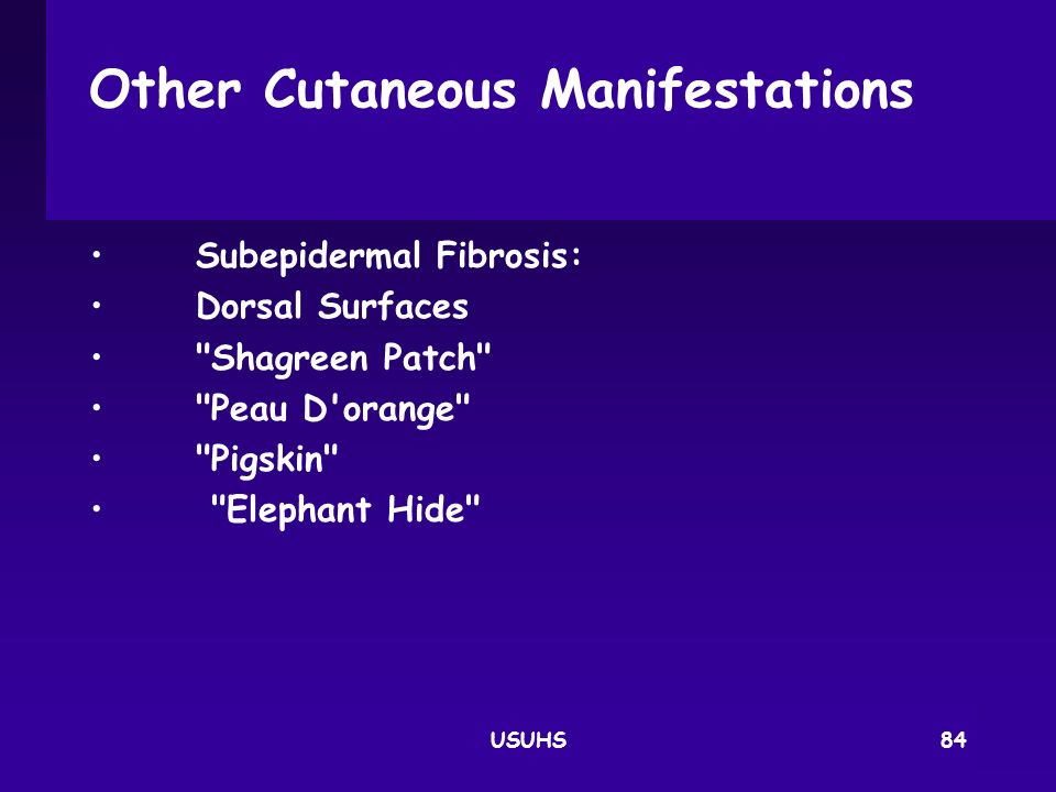Other Cutaneous Manifestations