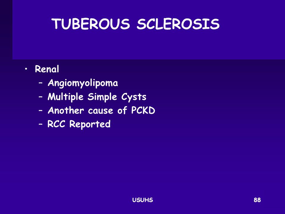 TUBEROUS SCLEROSIS Renal Angiomyolipoma Multiple Simple Cysts